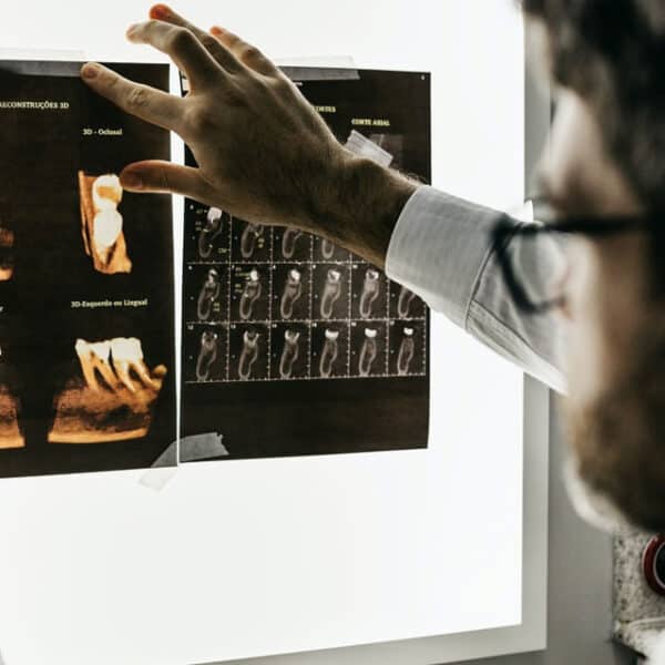 rtg zębów szczecin - gdzie je wykonać ile kosztuje